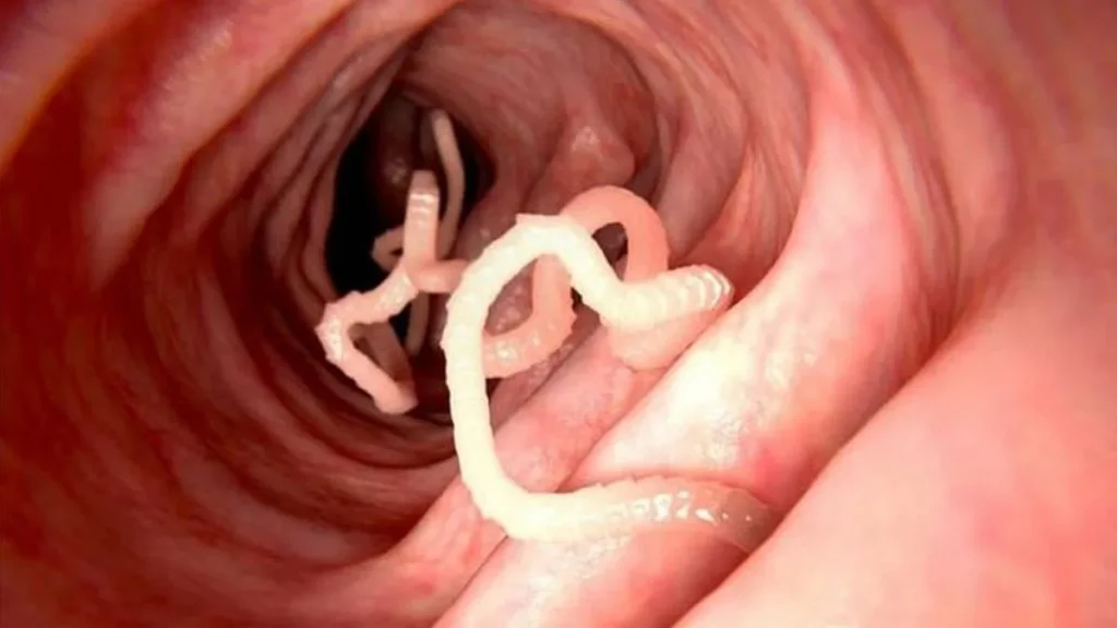 vermes intestinais