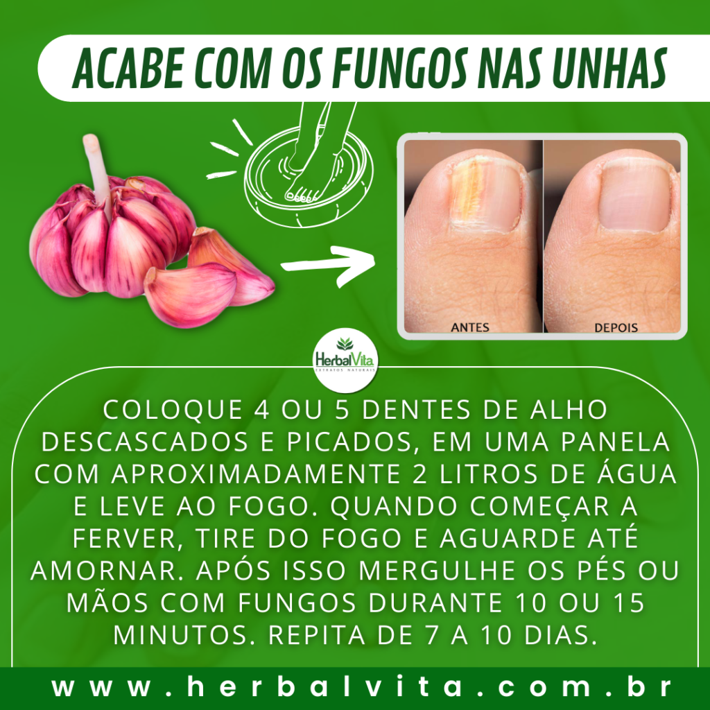 Alho para micose nas unhas